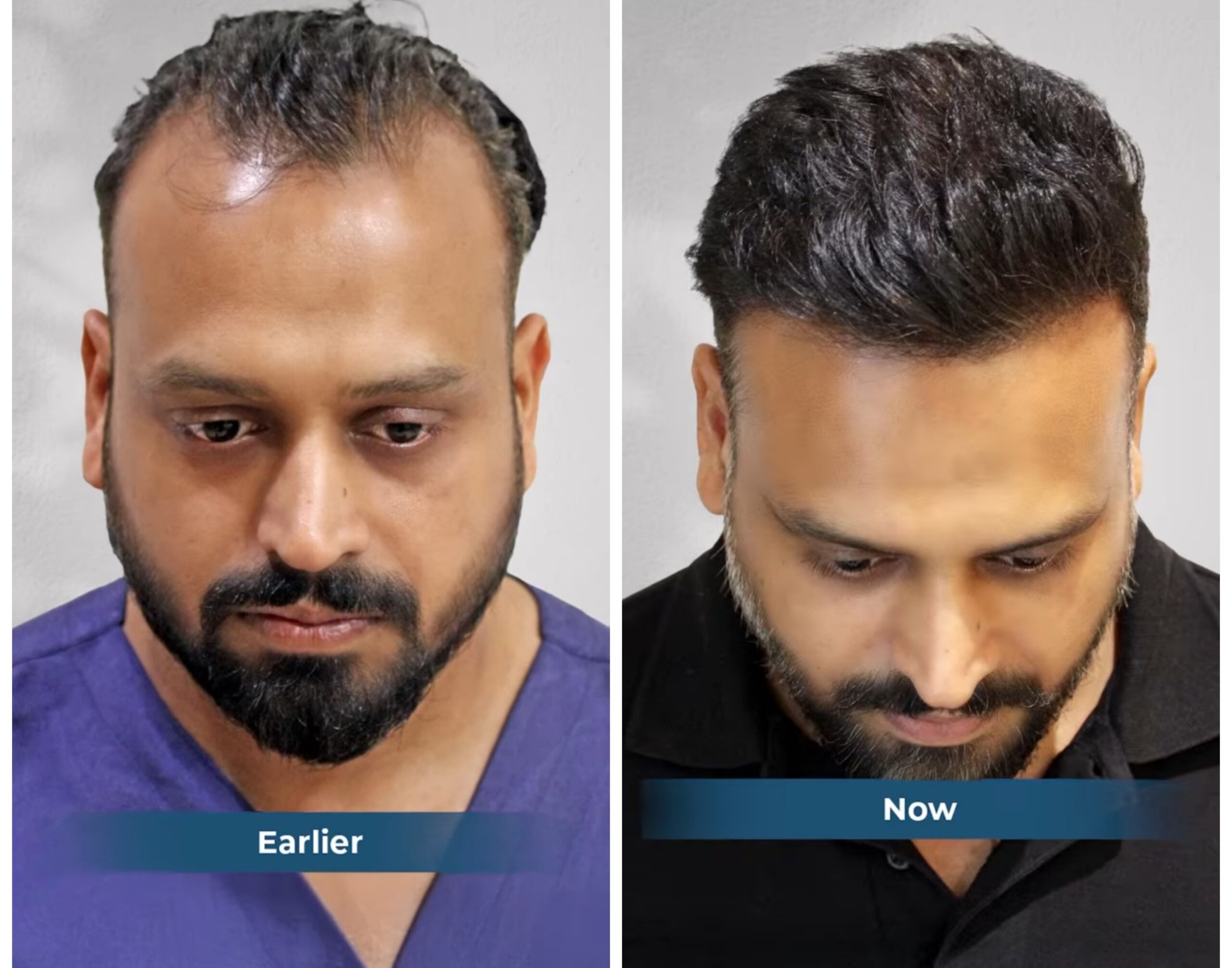 {"remix_data":[],"remix_entry_point":"challenges","source_tags":[],"origin":"unknown","total_draw_time":0,"total_draw_actions":0,"layers_used":0,"brushes_used":0,"photos_added":0,"total_editor_actions":{},"tools_used":{"transform":1},"is_sticker":false,"edited_since_last_sticker_save":true,"containsFTESticker":false}