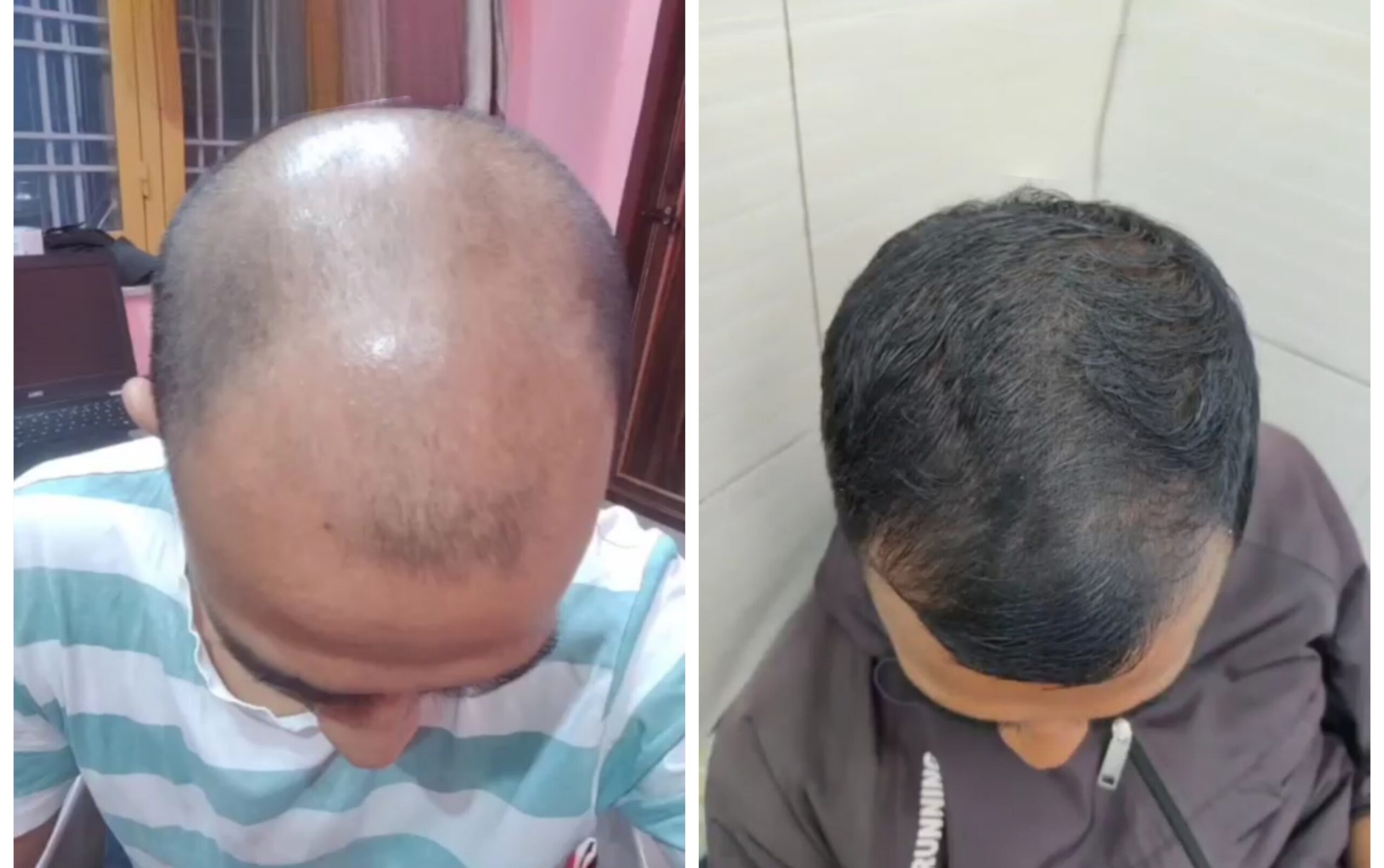 {"remix_data":[],"remix_entry_point":"challenges","source_tags":[],"origin":"unknown","total_draw_time":0,"total_draw_actions":0,"layers_used":0,"brushes_used":0,"photos_added":0,"total_editor_actions":{},"tools_used":{"transform":1,"remove":1},"is_sticker":false,"edited_since_last_sticker_save":true,"containsFTESticker":false}