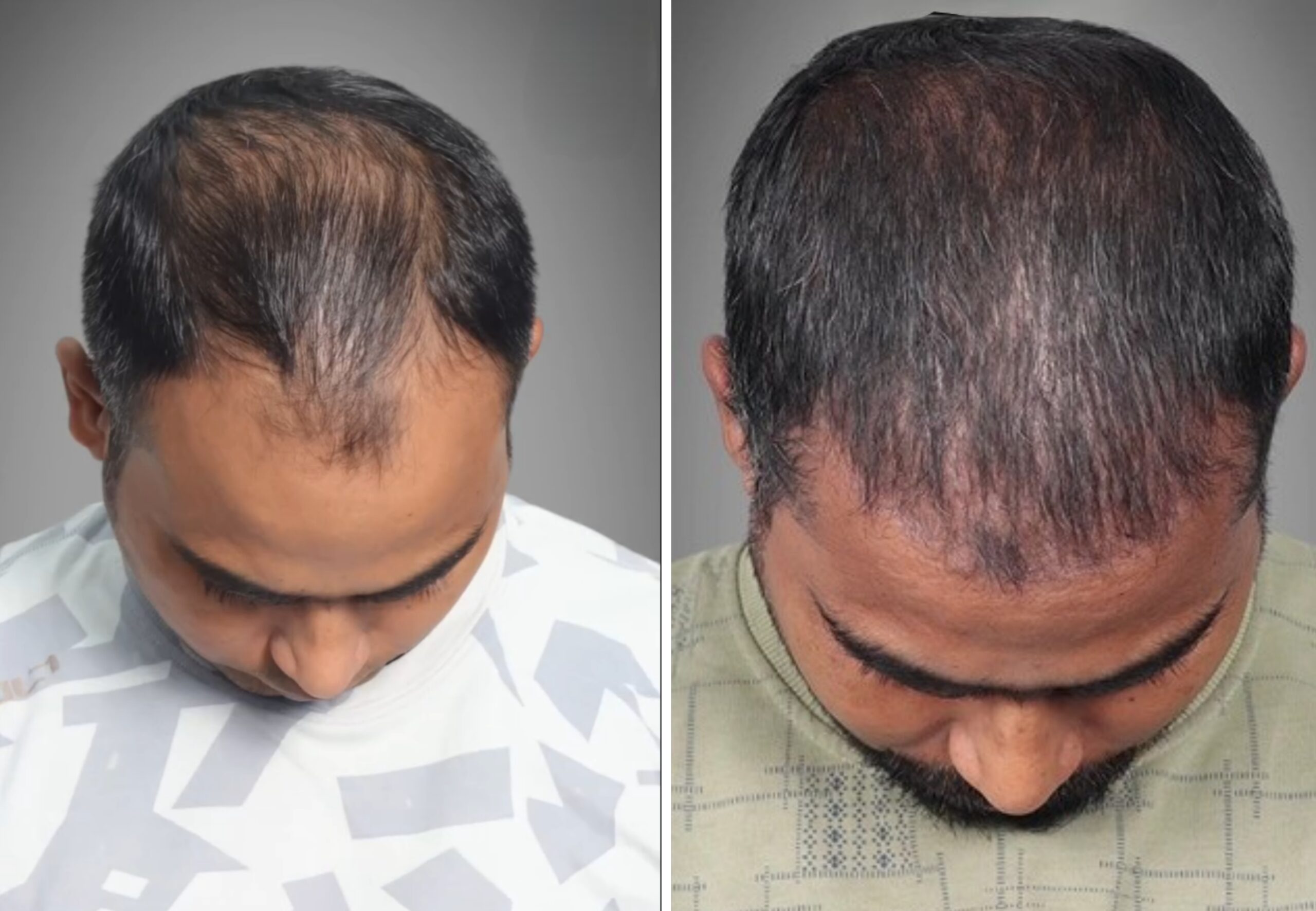 {"remix_data":[],"remix_entry_point":"challenges","source_tags":[],"origin":"unknown","total_draw_time":0,"total_draw_actions":0,"layers_used":0,"brushes_used":0,"photos_added":0,"total_editor_actions":{},"tools_used":{"transform":1,"remove":1},"is_sticker":false,"edited_since_last_sticker_save":true,"containsFTESticker":false}